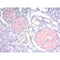 Amyloid Stain Kit (Congo Red), Volume Optimized