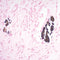 Calcium Stain Kit, (Modified Von Kossa), Volume Optimized