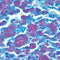 Fite Stain Kit (Leprosy & Nocardia), Volume Optimized
