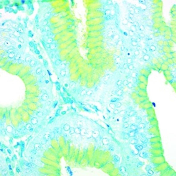 H. Pylori Stain Kit, Alcian Yellow, Volume Optimized