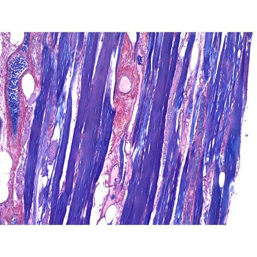 PTAH Stain Kit (Microwave), Volume Optimized
