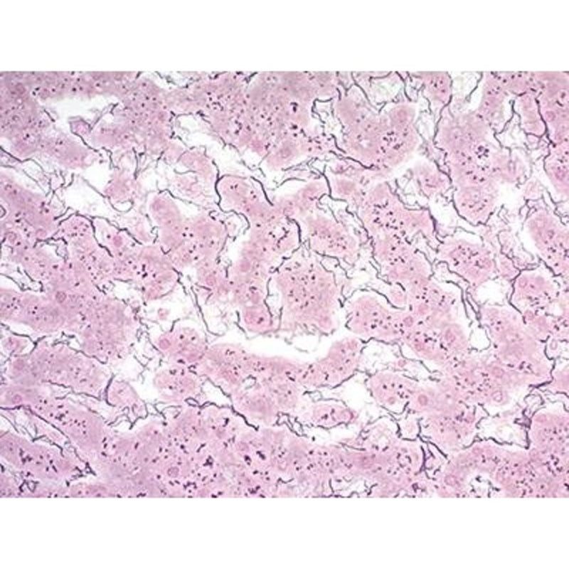 Reticulum Stain Kit (Brenn), Volume Optimized