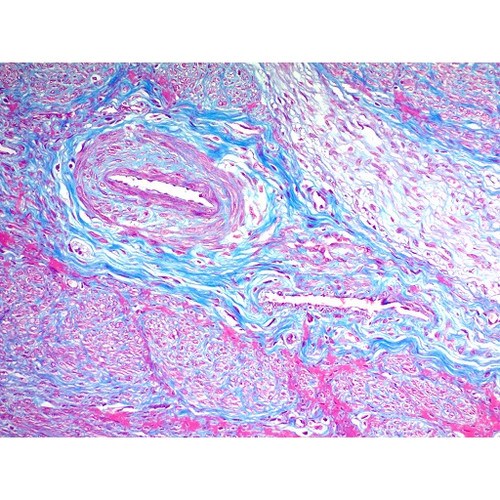 Trichrome SK (Modified Gomori's)