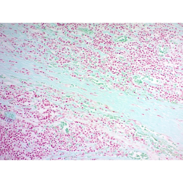 Twort's Counterstain Kit, Volume Optimized