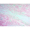 Twort's Counterstain Kit, Volume Optimized