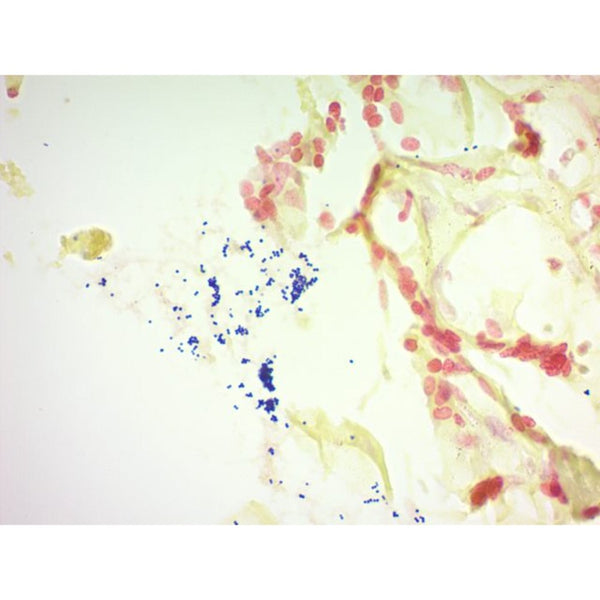 Gram Stain Kit (Modified Brown & Brenn), Volume Optimized