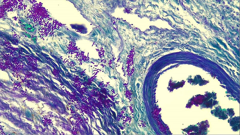 Periodic Acid-Schiff's (PAS), Nuclear Stain Bundle (16oz)