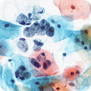 Rankin EA-50 Papanicolaou stain consumables in a gallon bottle for cytology and Pap smear sample preparation.