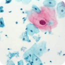 Rankin EA-65 Papanicolaou Stain consumables bottle, used for cytology staining in laboratory settings.