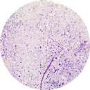 Rankin IHC control slides for adenovirus, including unstained and stained slides, used as consumables for immunohistochemistry testing.