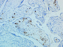 Rankin IHC Control Slides for CMV Cytomegalovirus detection, unstained and stained consumables used in laboratory diagnostics.