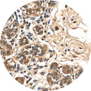Consummables Control Slides by Rankin, featuring unstained and stained slides for laboratory use in AKT testing.