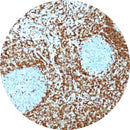 Rankin BCL 2 human control slides, consumables with unstained and stained samples for laboratory testing.
