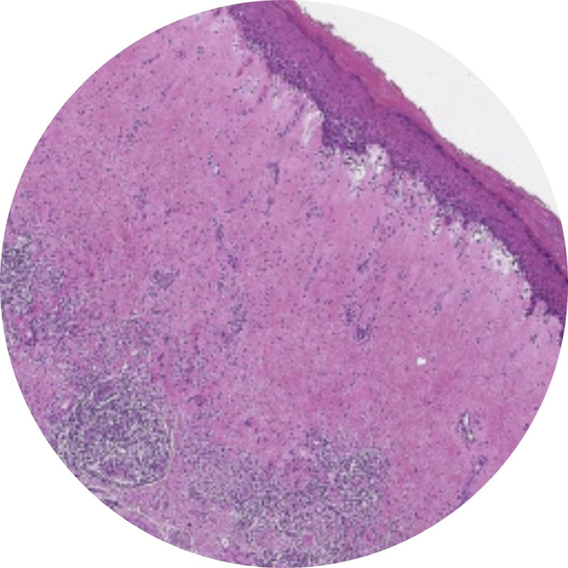 Control Slides, H&E - Human Foreskin for Accurate Histology