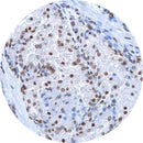 Rankin IHC Control Slides, 5-HMC, unstained and stained slides for immunohistochemistry testing, laboratory consumables
