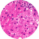 Rankin IHC Control Slides for AAT (Alpha-1 Antitrypsin), unstained and stained consumables for immunohistochemistry testing.