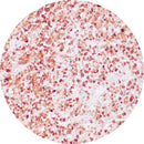Rankin IHC control slides for ACTH, including unstained and stained slides used in immunohistochemistry testing.