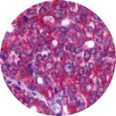 Control slides for IHC testing of adrenergic receptor beta 2, with unstained and stained samples, marketed by Rankin.