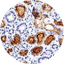 Control slides for IHC testing of Adrenomedullin by Rankin, showing unstained and stained tissue sections.