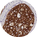 Rankin IHC control slides with unstained and stained samples for AE1/AE3, used as consumables in immunohistochemistry testing.