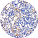 Rankin IHC AFP control slides with unstained and stained sections for immunohistochemistry testing, used as consumables in labs