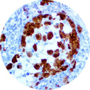 Rankin IHC ALK control slides for immunohistochemistry, featuring unstained and stained slides for laboratory testing.
