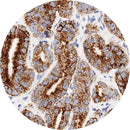Control slides for IHC testing of AMACR P504S, stained and unstained consumables by Rankin, used in pathology laboratory analysis.