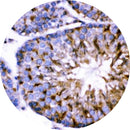 Rankin IHC Control Slides for AMHR2, unstained and stained slides for immunohistochemistry testing.
