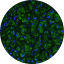 Rankin IHC control slides featuring unstained and stained amylase slides for immunohistochemistry testing.