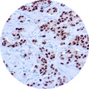 Rankin IHC Control Slides for Androgen, unstained and stained consumables used in immunohistochemistry testing.
