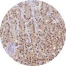 Rankin IHC Control Slides for Annexin A10, unstained and stained consumables for immunohistochemistry testing.