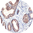 Rankin IHC control slides, unstained and stained, used for immunohistochemistry testing in laboratory consumables.