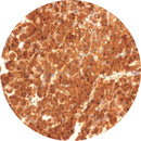 Rankin IHC control slides for Arginase-1, unstained and stained consumables used for immunohistochemistry testing.