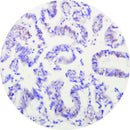 Rankin IHC control slides for ARID1A, featuring unstained and stained slides used as consumables in immunohistochemistry testing.