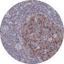Rankin IHC Control Slides for Aurora B, unstained and stained slides used as consumables in immunohistochemistry testing.