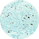 Unstained and stained control slides for IHC testing of Aurora Kinase 2, produced by Rankin, showing sample preparation and slide details.