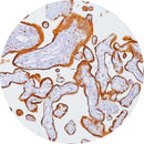 Rankin Control Slides for IHC B-HCG testing, unstained and stained slides used as consumables in laboratory diagnostics.