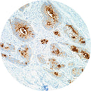 Rankin IHC Control Slides B72.3, unstained and stained consumables for immunohistochemistry testing, shown in the image.