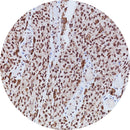 Rankin IHC control slides for BAP-1, including unstained and stained slides, used as consumables in immunohistochemistry testing.
