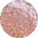 Rankin IHC BCL 1 control slides for immunohistochemistry, featuring unstained and stained samples on glass slides.