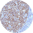 Rankin BCL6 IHC control slides, unstained and stained consumables for immunohistochemistry testing, showcasing slide samples.