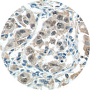 Rankin IHC control slides for BCL 9, featuring unstained and stained tissue samples for immunohistochemistry testing.