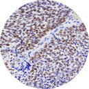 Rankin BCOR control slides for IHC, featuring unstained and stained slides used for immunohistochemistry testing.