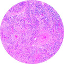 Rankin IHC control slides with unstained and stained sections for BerEp4, used as consumables in immunohistochemistry testing.