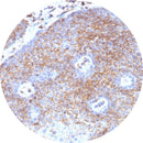 Rankin IHC control slides for Beta-2 Microglobulin (B2M), unstained and stained consumable slides for immunohistochemistry testing.