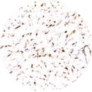 Rankin IHC Control Slides featuring unstained and stained Beta Catenin samples for immunohistochemistry testing.
