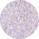 Rankin IHC control slides with unstained and stained sections for immunohistochemistry, used as consumables in laboratory testing.