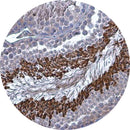 Rankin IHC control slides with unstained and stained samples for Brachyury, used as consumables in immunohistochemistry testing.