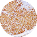Rankin BRAF control slides for immunohistochemistry, showing unstained and stained IHC control samples.