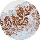 Rankin BRAF V600E IHC control slides, unstained and stained, for immunohistochemistry testing, used as consumables in pathology labs.